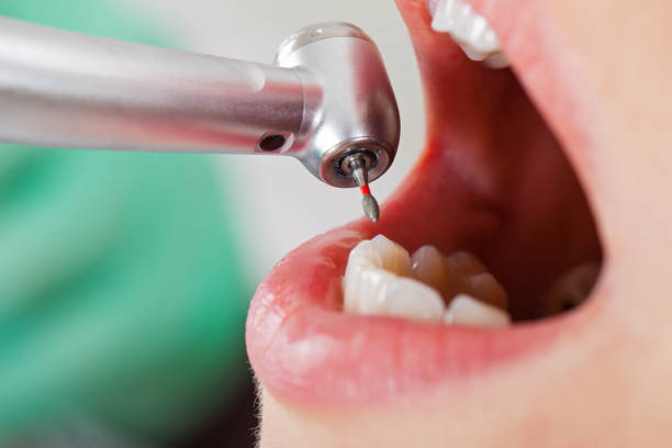 Best Mobile Emergency Dentist in Mariemont, OH